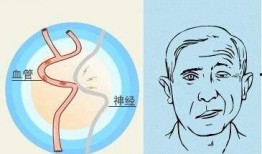 持续痉挛抽搐在线观看,在线观看专家解析与应对策略